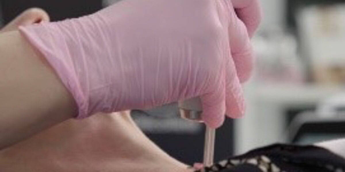 Neck Decolletage Laser treatment on neck area at Beauty Refined, Greenwood Village.