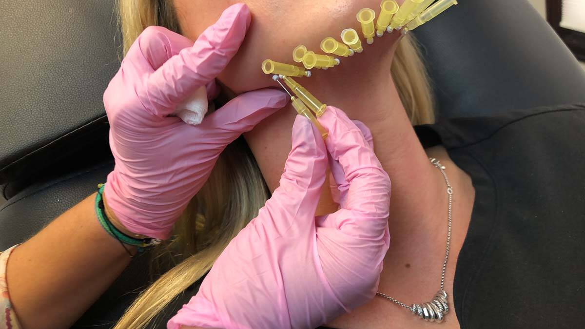 Non-Surgical Anti-Aging Treatment by Beauty Refined in Greenwood Village, CO