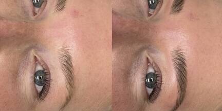 Before and After Gallery | Beauty Refined