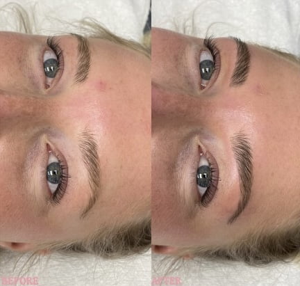 Before and After Gallery | Beauty Refined