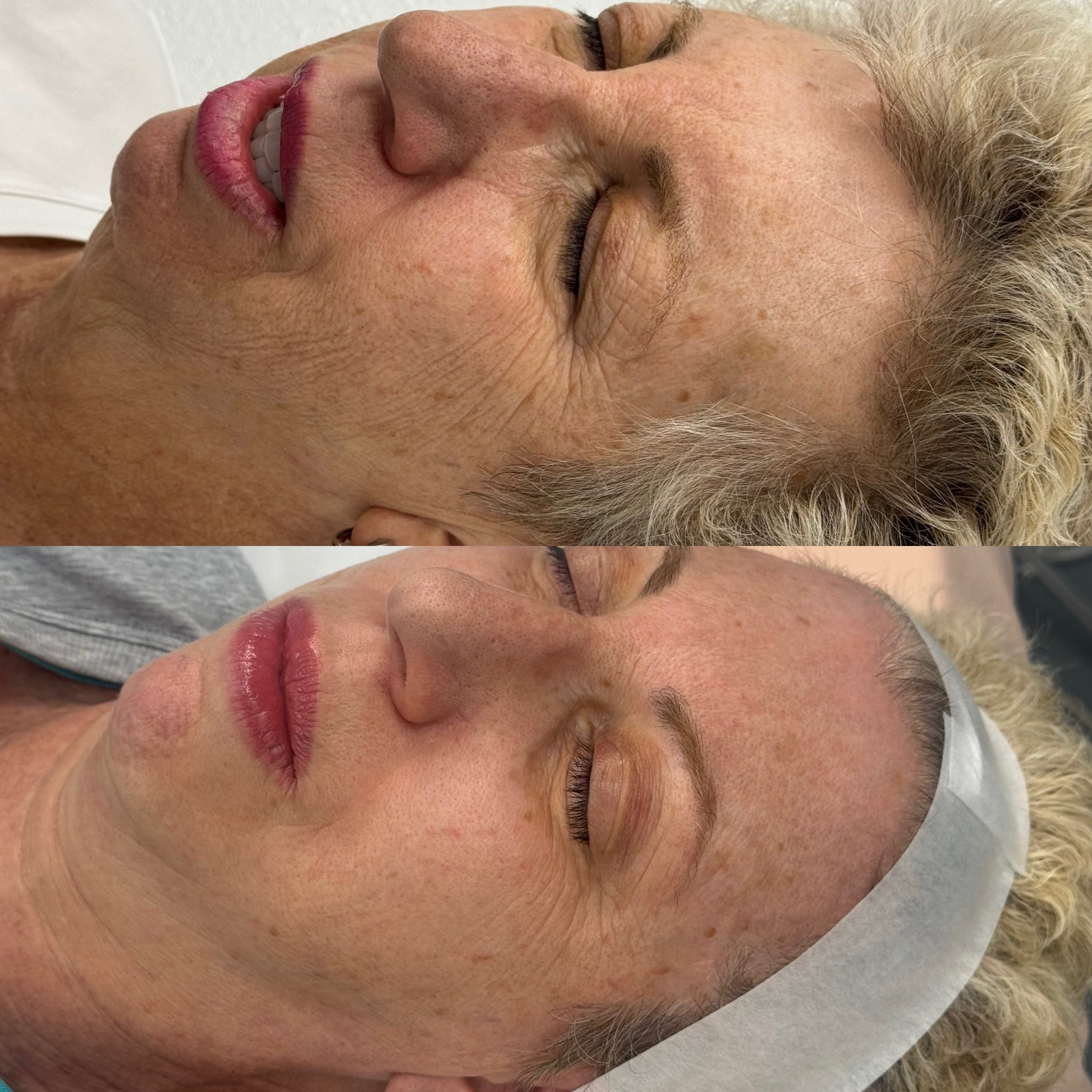 Before and After Gallery | Beauty Refined